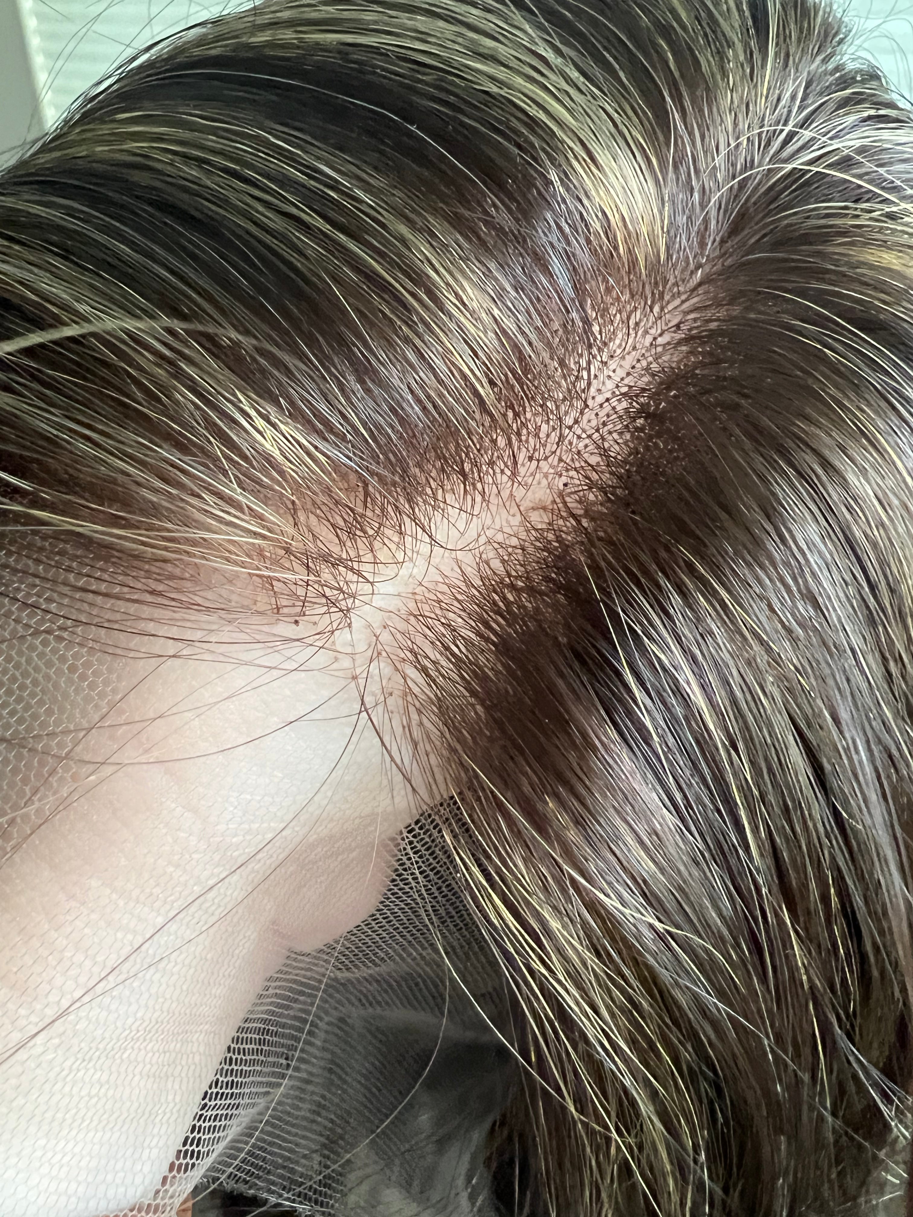 "Doris" Lace Top Wig (M)