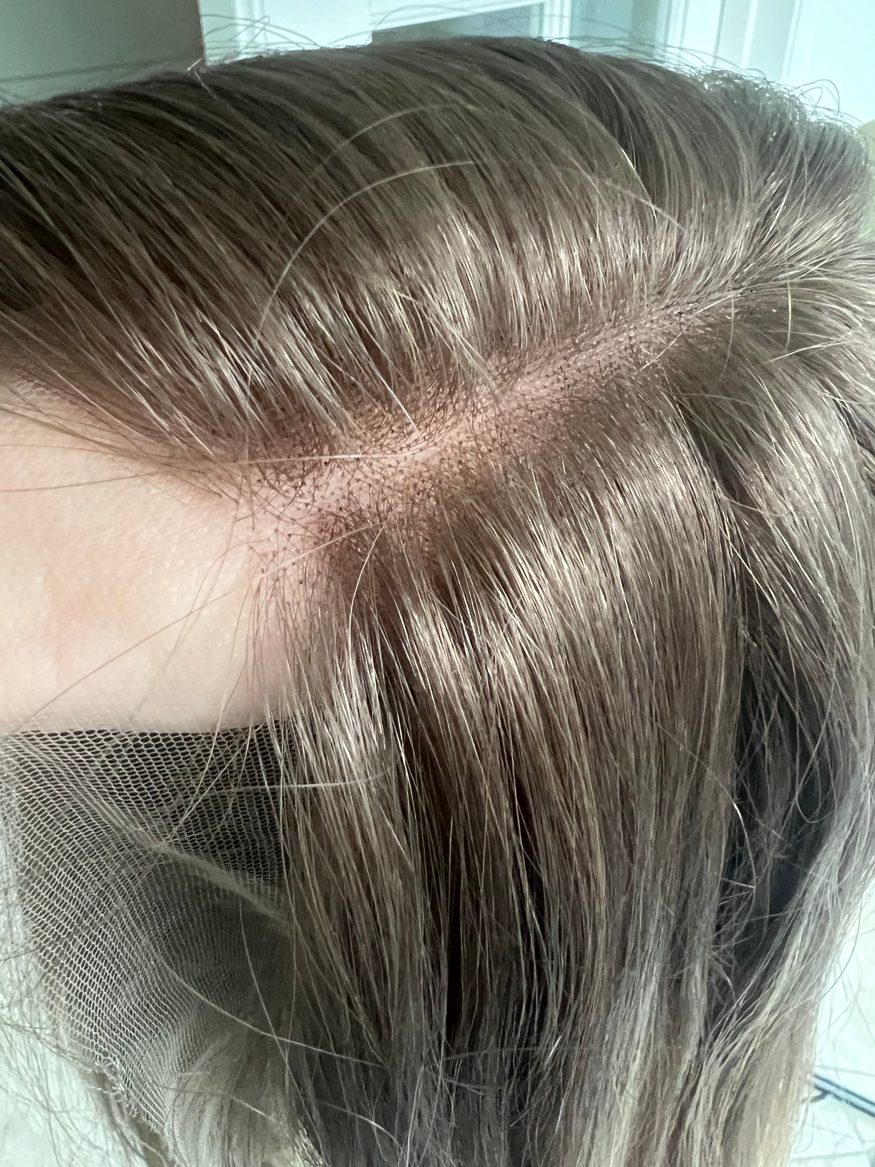 "Nixie" Lace Top Wig (M)